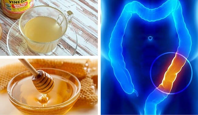 Limpia tu colon con esta mezcla de dos ingredientes