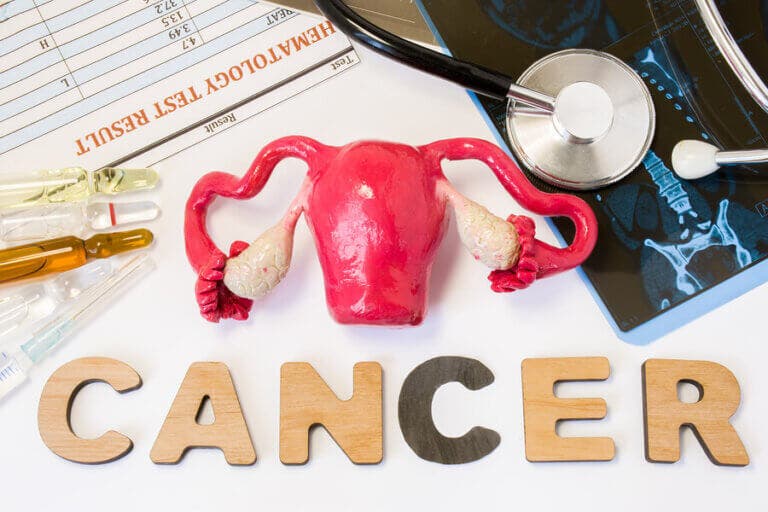 Los 5 tipos de cáncer más frecuentes en la mujer