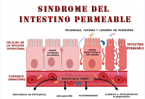 intestino-permeable1