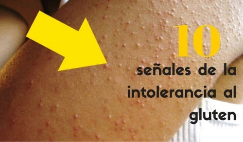 10 señales de la intolerancia al gluten
