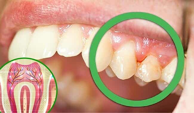 6 razones por las que te duelen los dientes