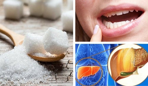 8 problemas de salud que ocasiona comer demasiado azúcar