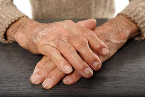 Alivia la artritis