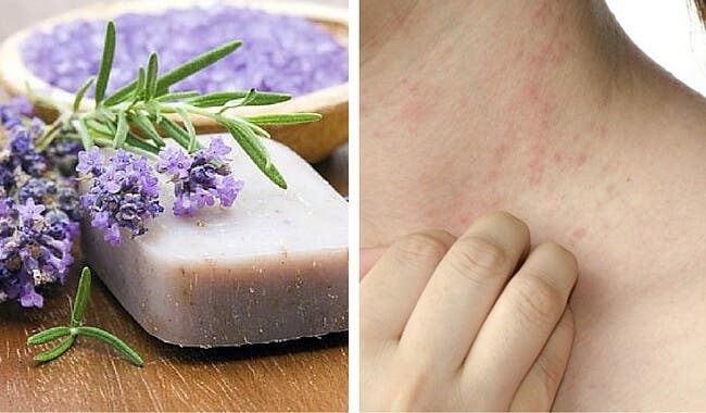 Jabón especial casero para pieles delicadas y con dermatitis