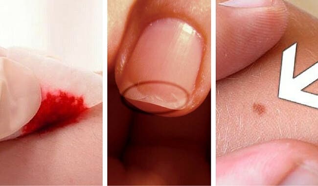 5 razones sorpresivas para visitar al dermatólogo