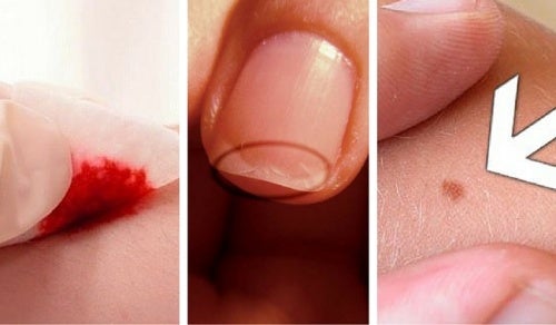 5 razones sorpresivas para visitar al dermatólogo
