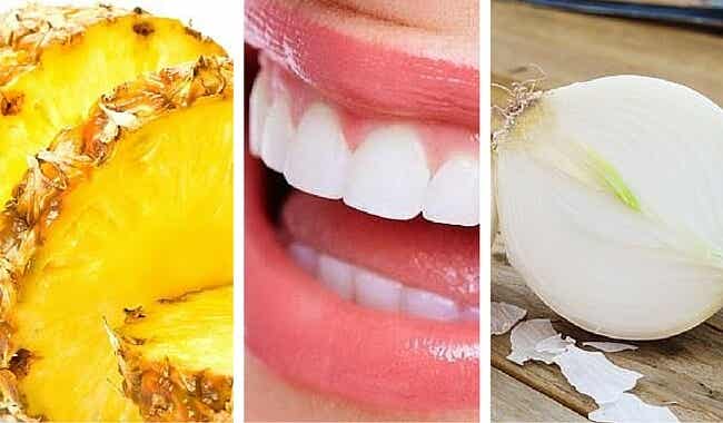 7 alimentos que blanquean tus dientes naturalmente
