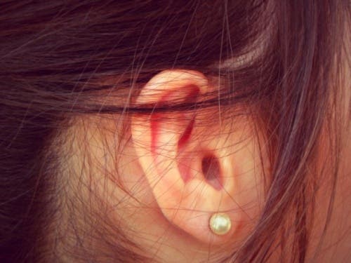 Aretes