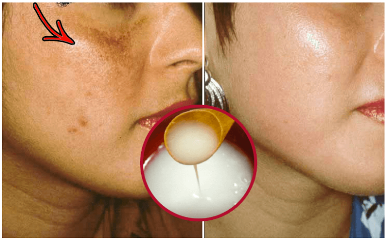 Cómo preparar una crema natural para blanquear el cutis en poco tiempo