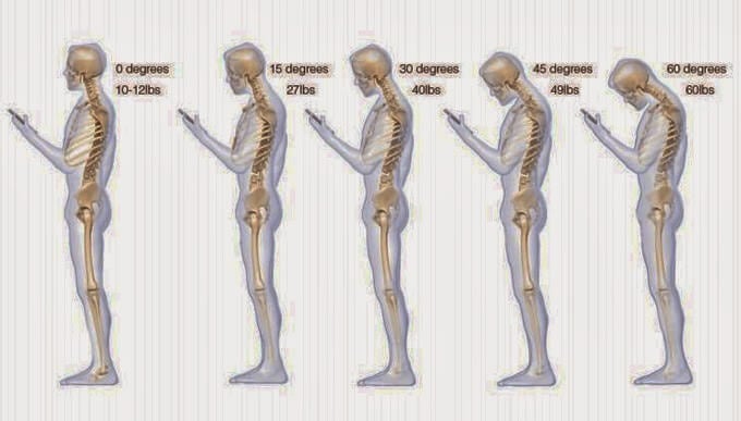 6 hábitos que están dañando tu cuello