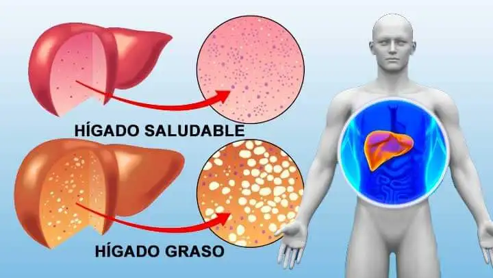 10 alimentos que puedes incluir en tu dieta para limpiar el hígado