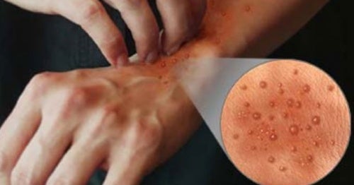4 razones por las que puedes sufrir una intoxicación alimentaria