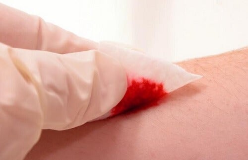 Papir duppes på sår for at fjerne blod
