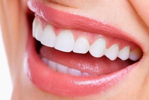 blanquear dientes