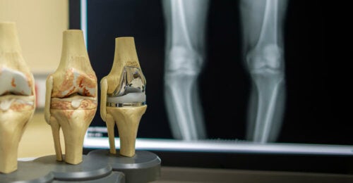 4 cosas que dicen tus rodillas sobre tu salud