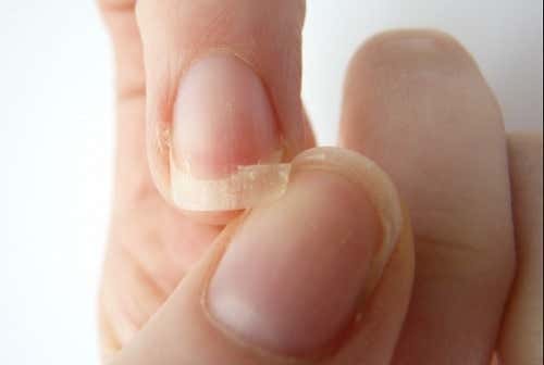 Centella asiática para uñas frágiles
