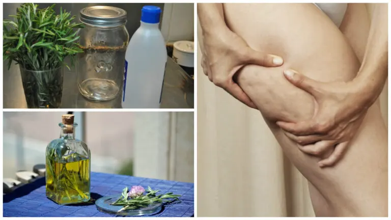 Aprende a preparar alcohol de romero casero para combatir la celulitis