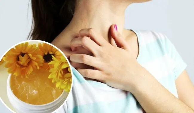 Aprende a elaborar un bálsamo casero y natural para los eczemas