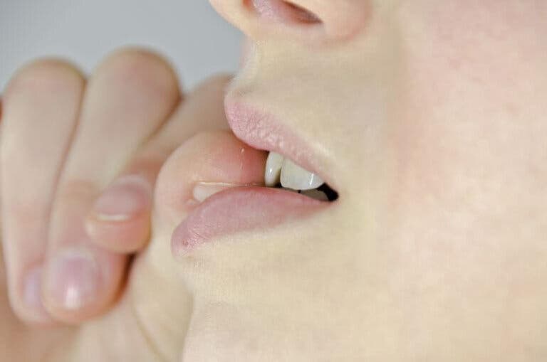 7 razones por los cuales comerse las uñas es malo