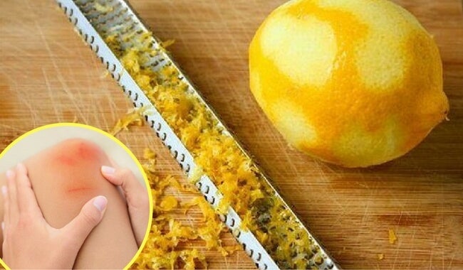Cómo utilizar cáscara de limón para calmar el dolor en las articulaciones