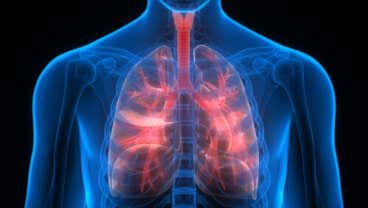 Remedios naturales contra la enfermedad pulmonar obstructiva crónica