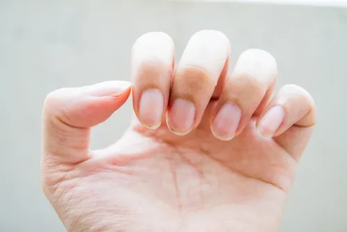 Uñas