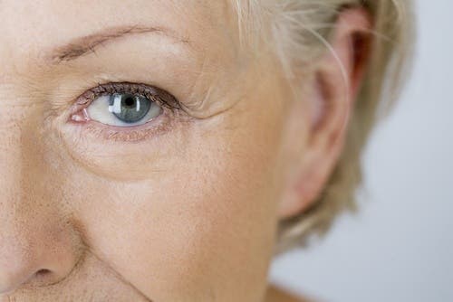 Mujer con síntomas de envejecimiento