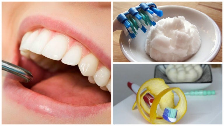 7 trucos caseros para remover el sarro acumulado en los dientes
