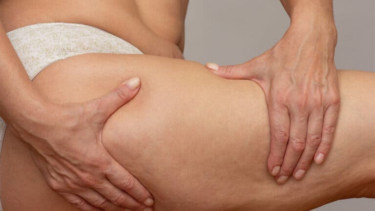 7 ejercicios para combatir la flacidez en las piernas