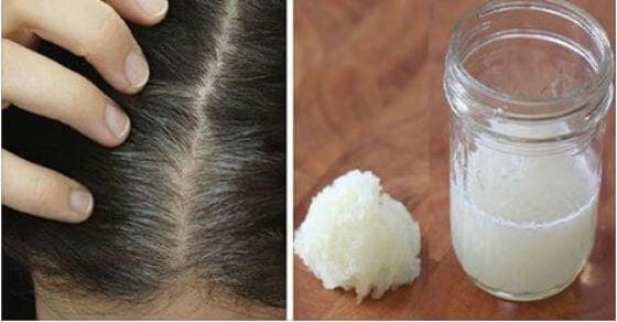 Tratamiento casero de cebolla y miel para combatir la pérdida del cabello