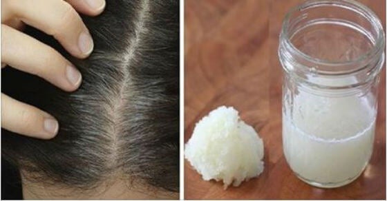 Tratamiento casero de cebolla y miel para combatir la pérdida del cabello