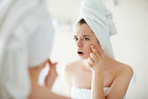 5 aceites esenciales para combatir el acné
