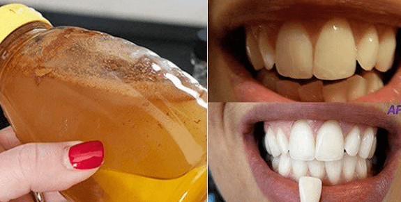 Blanquea tus dientes de forma natural con un ingrediente 100% natural