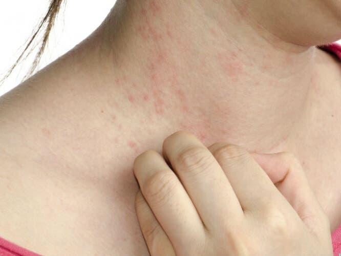 5 síntomas poco conocidos de la diabetes