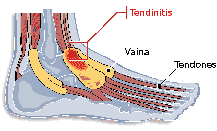 Ubicación de vaina y tendones
