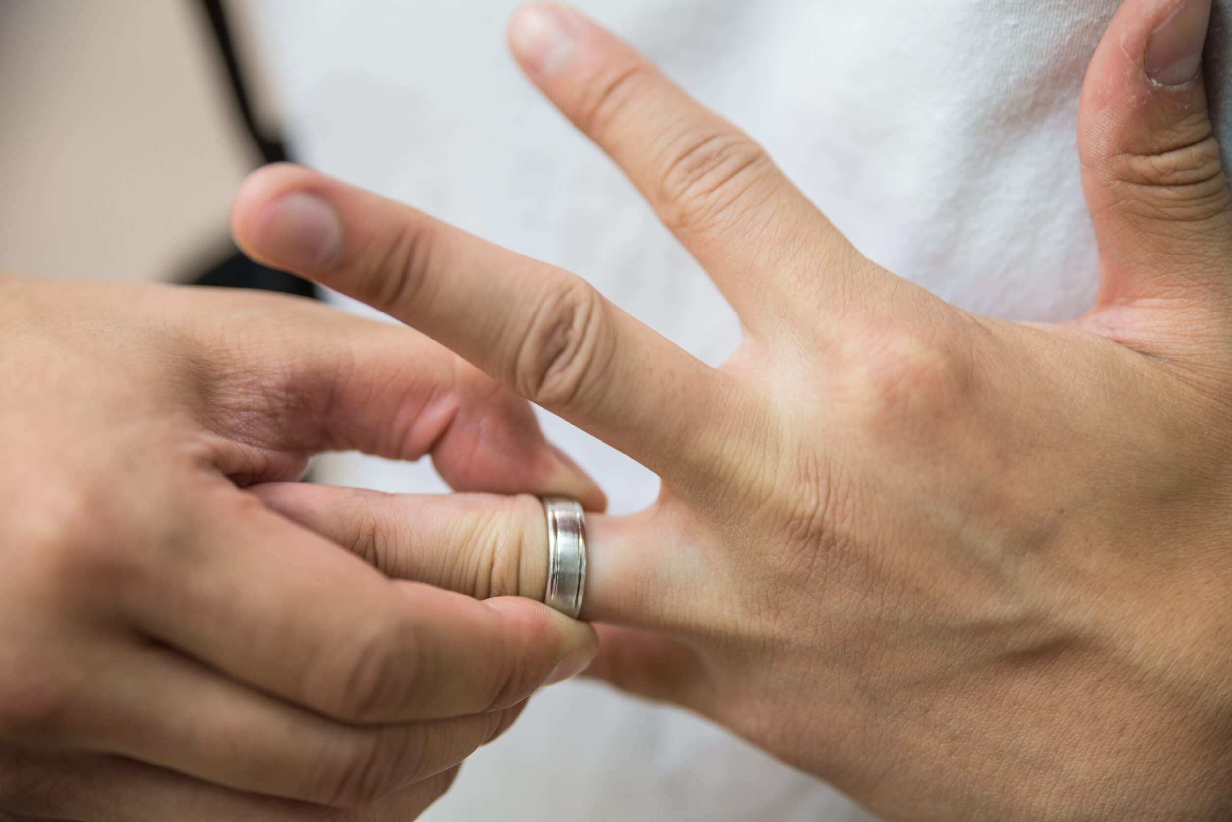 El jabón neutro sirve para extraer un anillo apretado