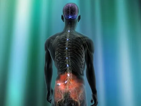 Neurostimulador para el dolor neuropático.