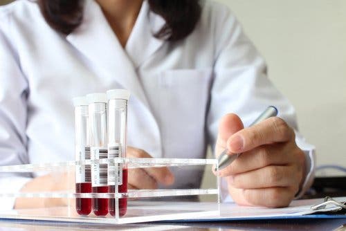 Médico con análisis de sangre.