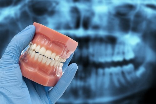 No enderezar los dientes en casa, siempre acudir a un profesional