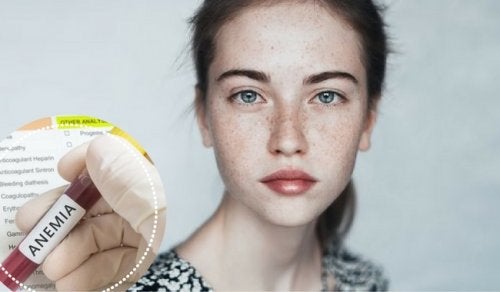 ¿La anemia afecta a nuestras emociones?