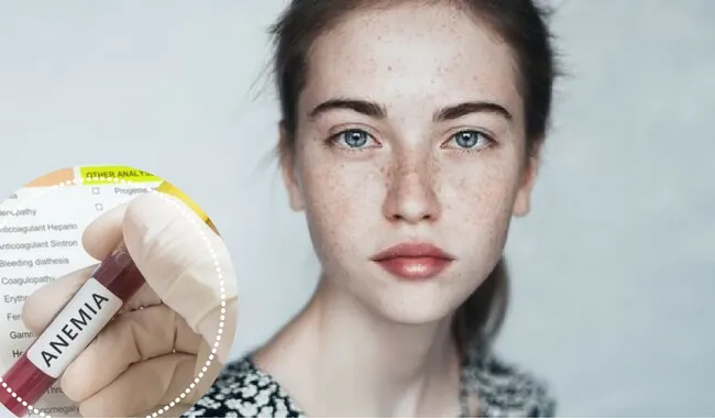 ¿La anemia afecta a nuestras emociones?