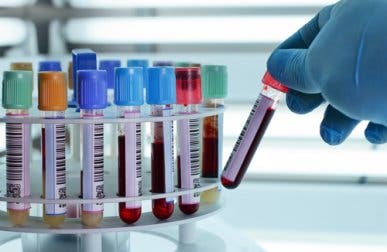 Un análisis de sangre para diagnosticar la depresión