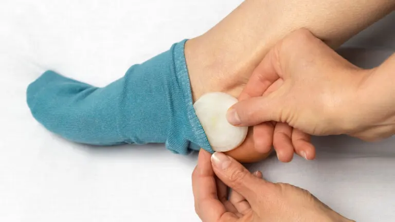 ¿Cuáles son los beneficios de dormir con cebolla en los pies?