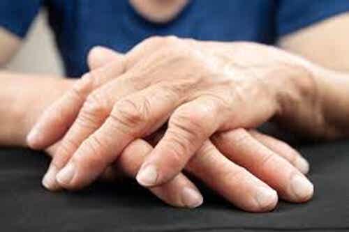 Una nueva forma de tratar la artritis
