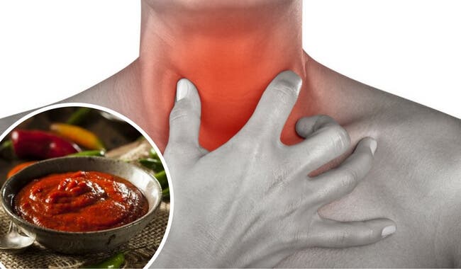 Si te duele la garganta no comas estos 7 alimentos