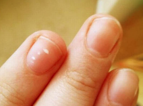 Uñas
