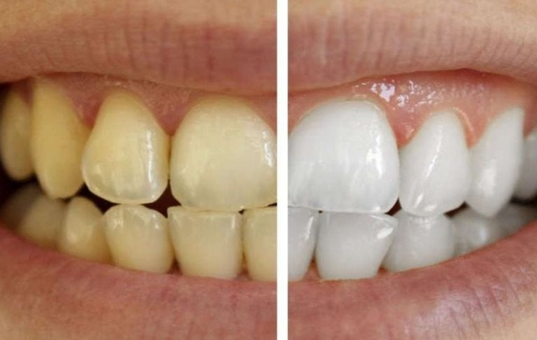 Cuida tus dientes con productos 100% naturales