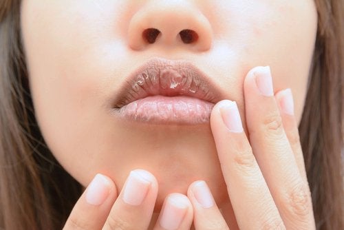 Las aspirinas pueden ayudarte con los labios agrietados