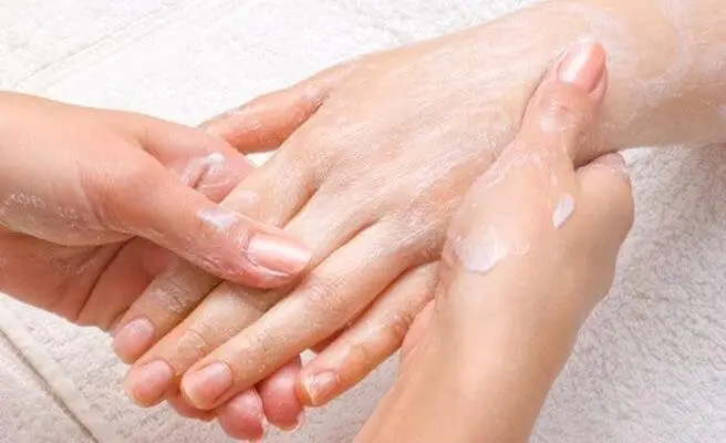 7 remedios caseros para los sabañones