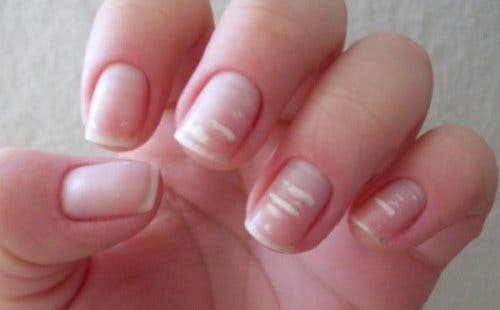 uÑAS
